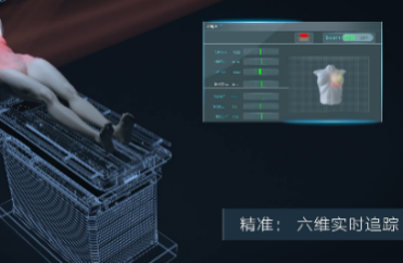 治疗区域实时监控