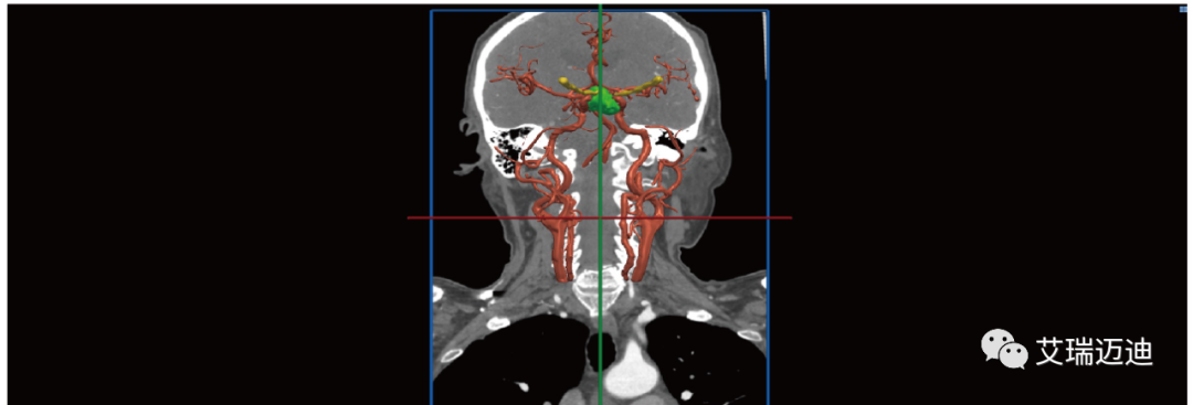 640 (2).png