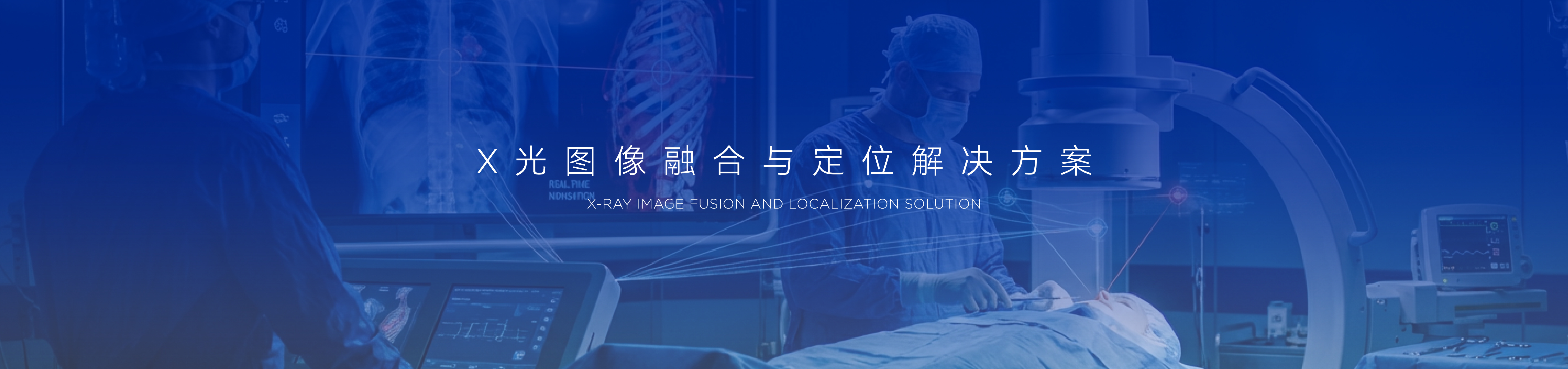 X光图像处理与定位解决方案